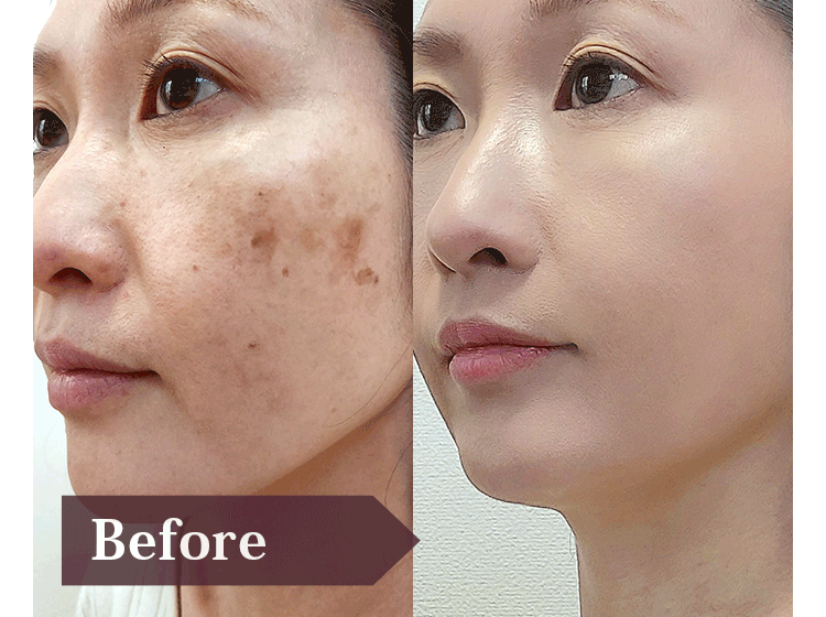 Before/Afeter